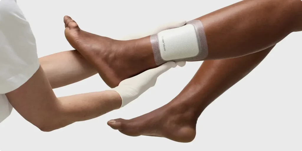 پانسمان نوین چیست؟کاربرد،عوارض،مزایا و انواع