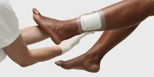 پانسمان نوین چیست؟کاربرد،عوارض،مزایا و انواع